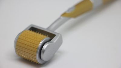 microneedling